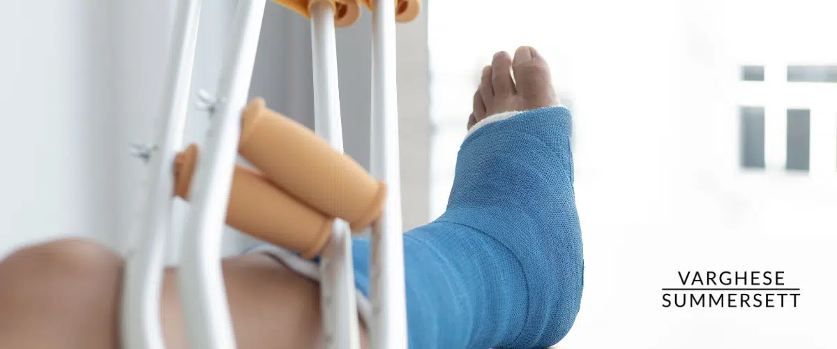 Broken leg from car accident
