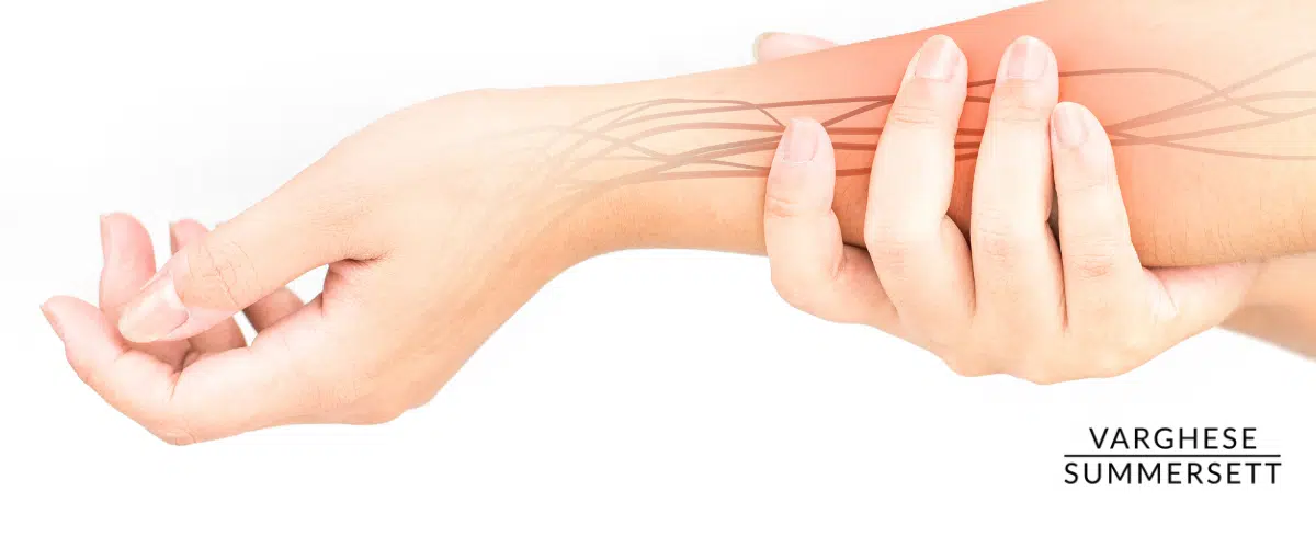 Nerve damage possible from car accident