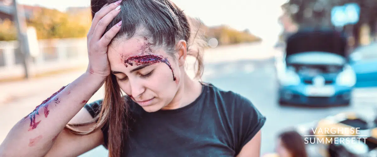 Forehead cut from Car Accident