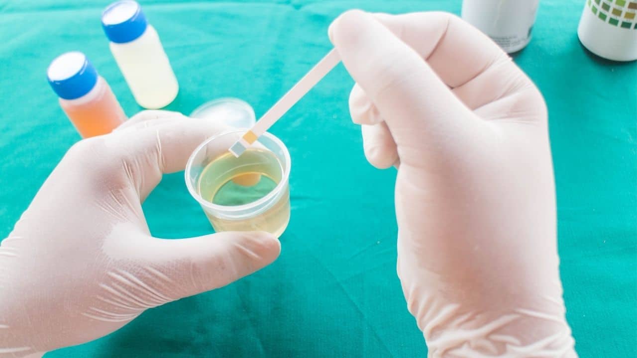 Drug Testing in Child Custody Cases