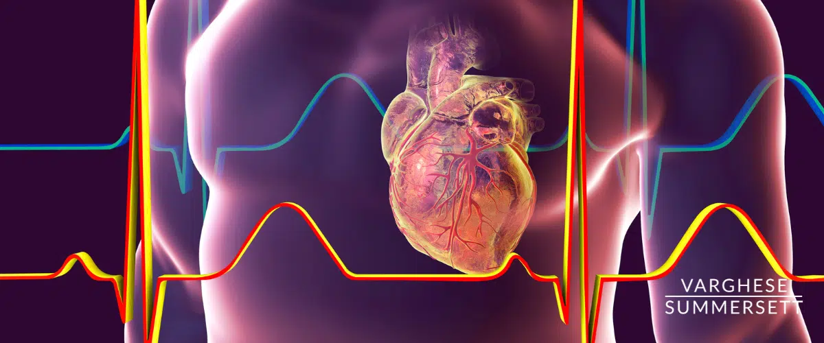 Heart Trauma is possible from a car accident